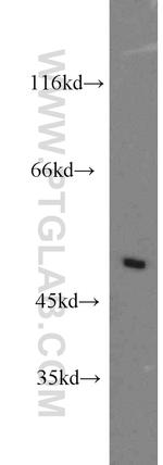 ZMYND10 Antibody in Western Blot (WB)