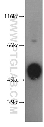 STK17A Antibody in Western Blot (WB)