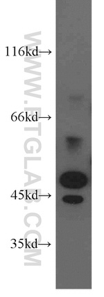 STK17A Antibody in Western Blot (WB)