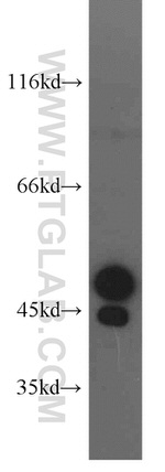 STK17A Antibody in Western Blot (WB)