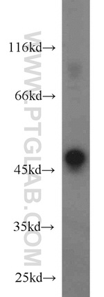 STK17A Antibody in Western Blot (WB)