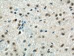 PPME1 Antibody in Immunohistochemistry (Paraffin) (IHC (P))