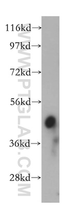 PPME1 Antibody in Western Blot (WB)