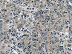 TMPRSS2 Antibody in Immunohistochemistry (Paraffin) (IHC (P))