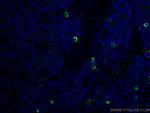 TMPRSS2 Antibody in Immunohistochemistry (PFA fixed) (IHC (PFA))