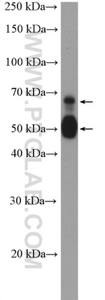 TMPRSS2 Antibody in Western Blot (WB)