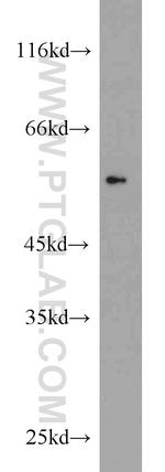 V5-tag Antibody in Western Blot (WB)