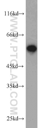 V5-tag Antibody in Western Blot (WB)