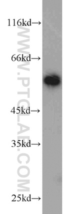 V5-tag Antibody in Western Blot (WB)