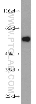 V5-tag Antibody in Western Blot (WB)