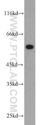 V5-tag Antibody in Western Blot (WB)