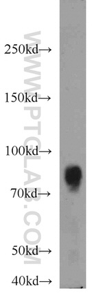 RSK3 Antibody in Western Blot (WB)