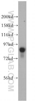 RSK3 Antibody in Western Blot (WB)