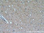 RABGGTA Antibody in Immunohistochemistry (Paraffin) (IHC (P))