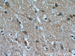 RABGGTA Antibody in Immunohistochemistry (Paraffin) (IHC (P))