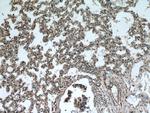 RABGGTA Antibody in Immunohistochemistry (Paraffin) (IHC (P))