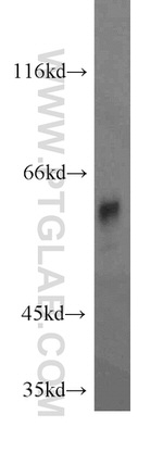 RABGGTA Antibody in Western Blot (WB)