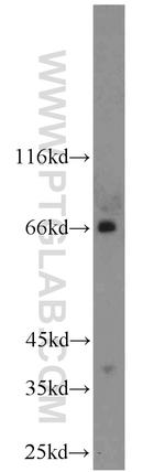 TSHR Antibody in Western Blot (WB)