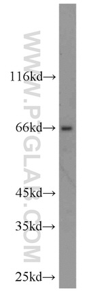 TSHR Antibody in Western Blot (WB)