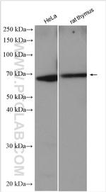 TSHR Antibody in Western Blot (WB)