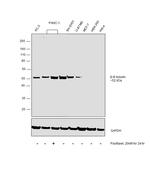 beta-3 Tubulin Antibody