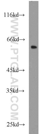 PLVAP Antibody in Western Blot (WB)