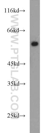 PLVAP Antibody in Western Blot (WB)