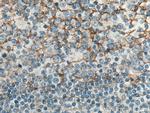 B7-H3 Antibody in Immunohistochemistry (Paraffin) (IHC (P))