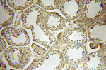 B7-H3 Antibody in Immunohistochemistry (Paraffin) (IHC (P))