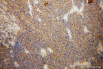 B7-H3 Antibody in Immunohistochemistry (Paraffin) (IHC (P))