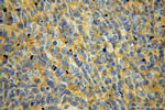 B7-H3 Antibody in Immunohistochemistry (Paraffin) (IHC (P))