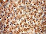 BBS9 Antibody in Immunohistochemistry (Paraffin) (IHC (P))