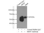 BBS9 Antibody in Immunoprecipitation (IP)