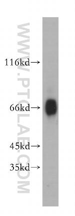 BBS9 Antibody in Western Blot (WB)