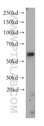 BBS9 Antibody in Western Blot (WB)