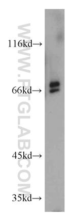 AMH Antibody in Western Blot (WB)