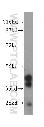 PARVB Antibody in Western Blot (WB)