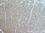 FECH Antibody in Immunohistochemistry (Paraffin) (IHC (P))