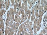 FECH Antibody in Immunohistochemistry (Paraffin) (IHC (P))