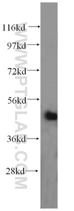 FECH Antibody in Western Blot (WB)