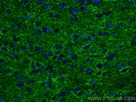 VGAT Antibody in Immunohistochemistry (PFA fixed) (IHC (PFA))