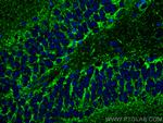 VGAT Antibody in Immunohistochemistry (PFA fixed) (IHC (PFA))