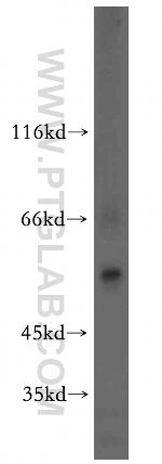 VGAT Antibody in Western Blot (WB)