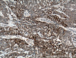 GSTA1 Antibody in Immunohistochemistry (Paraffin) (IHC (P))