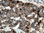 GSTA1 Antibody in Immunohistochemistry (Paraffin) (IHC (P))