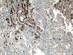 GSTA1 Antibody in Immunohistochemistry (Paraffin) (IHC (P))