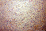 LCOR Antibody in Immunohistochemistry (Paraffin) (IHC (P))