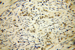 LCOR Antibody in Immunohistochemistry (Paraffin) (IHC (P))