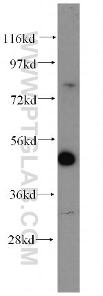 LCOR Antibody in Western Blot (WB)