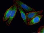 VAPB Antibody in Immunocytochemistry (ICC/IF)